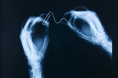 x rays on metal